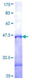SDS-PAGE (B4GALT1-028H).jpg